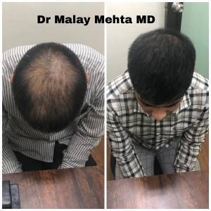 Dr. Malay Mehta